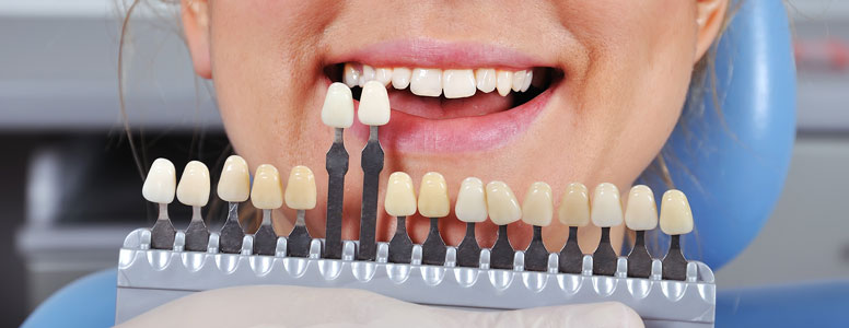 Moncton Dentist offering restorative dental service